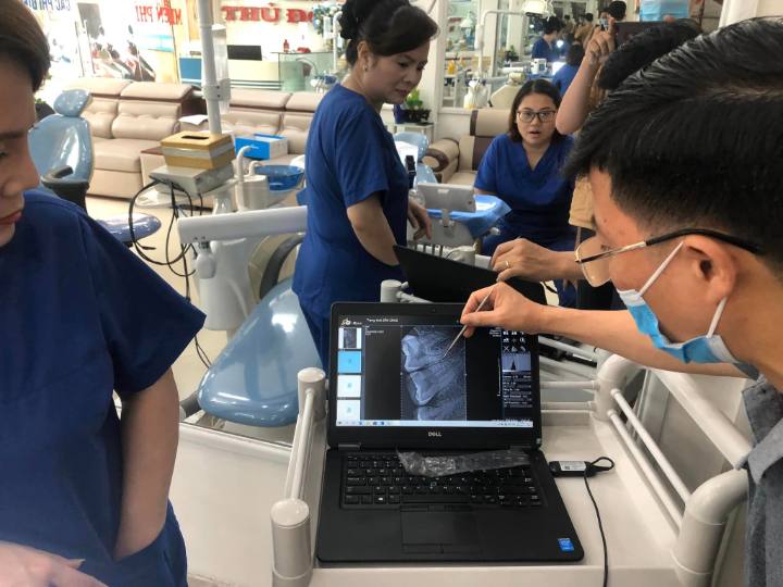 Ảnh X-quang răng siêu nét chụp bằng sensor lifedent trên phần mềm 9B-RAY